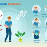 4 stages of appendicitis